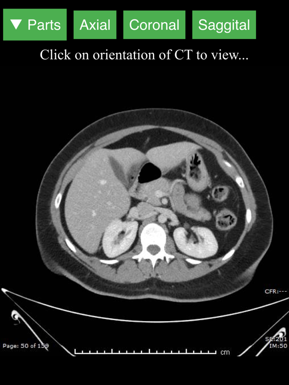 Radiology CT Viewerのおすすめ画像1