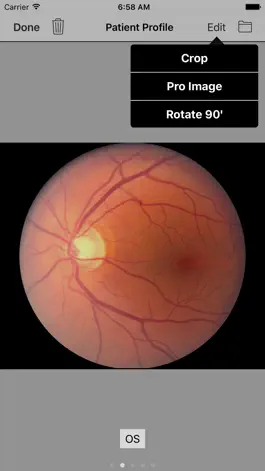 Game screenshot MII Ret Cam Pro-Patient Pofile hack