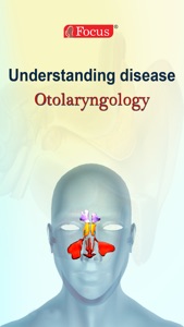 Otolaryngology - Understanding Disease screenshot #1 for iPhone