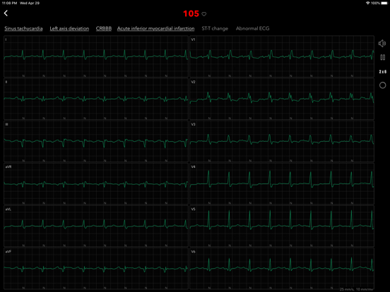 ECG for Doctors iPad screenshot 6 - Medical app