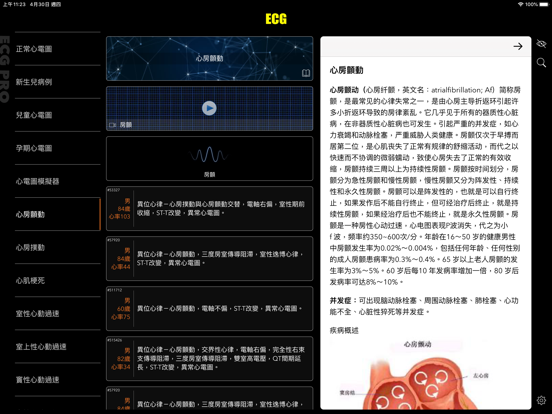 ECG Pro for Doctorsのおすすめ画像6