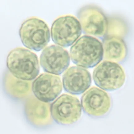 Protozoan Identification Cheats