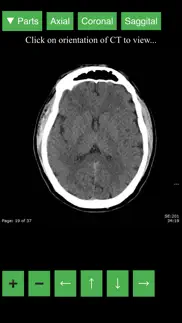 radiology ct viewer problems & solutions and troubleshooting guide - 3