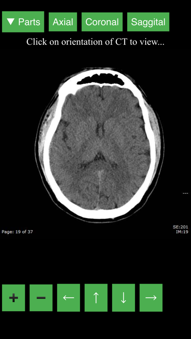 Radiology CT Viewer Screenshot