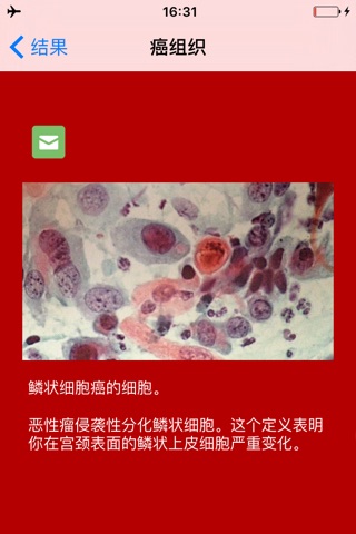 Pap Test screenshot 4