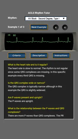 Game screenshot ACLS Rhythm Tutor apk