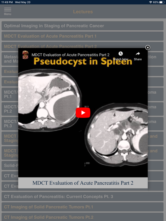 CTisus Pancreas Compendiumのおすすめ画像6