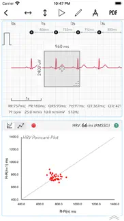 ecg+ | analyzer for qtc & hrv problems & solutions and troubleshooting guide - 4