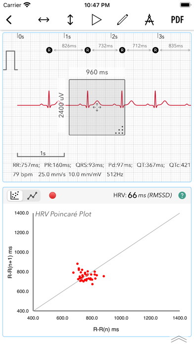 ECG+ | Analyzer for QTc & HRV Screenshot