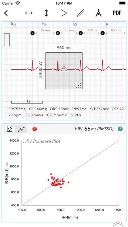 ECG+ | Analyzer for QTc & HRV screenshot-7