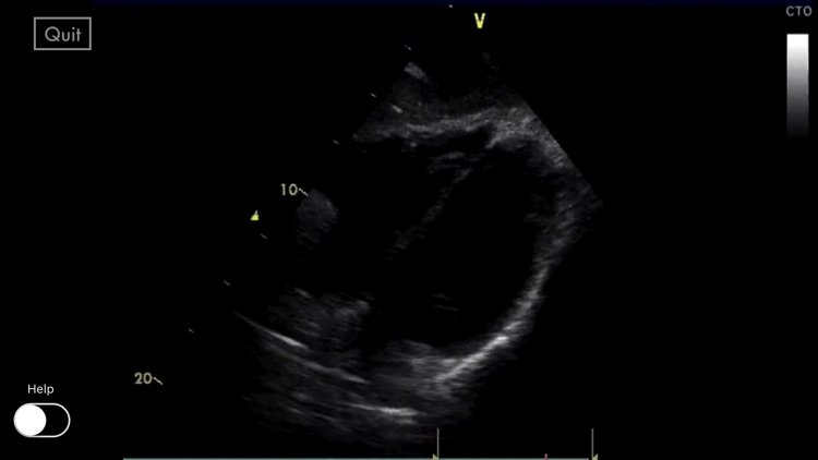 Awesome Ultrasound Simulator