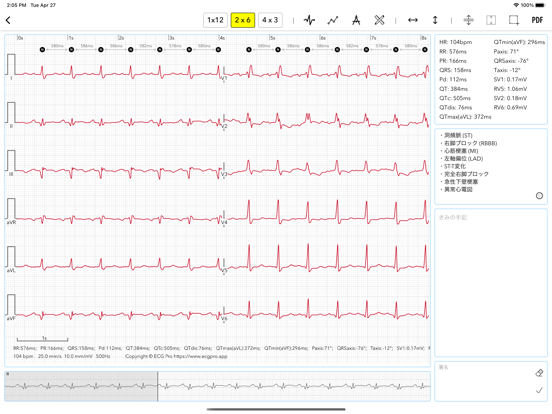 ECG Pro for Doctorsのおすすめ画像2