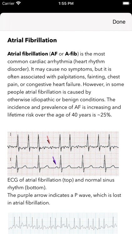 ECG for Doctors screenshot-8