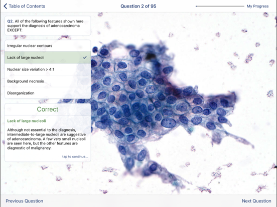 Johns Hopkins Atlas of Pancreatic Cytopathologyのおすすめ画像5