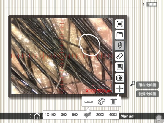 Screenshot #5 pour myscalp