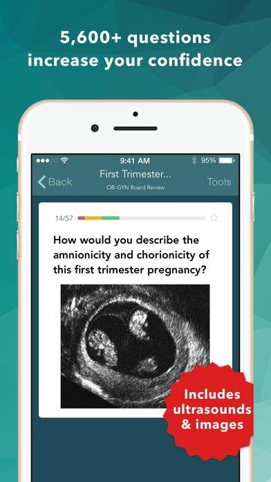 Ob Gyn Board Review Flashcardsのおすすめ画像1