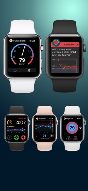 Apple watch top monitoraggio cuore