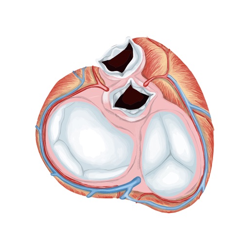 Mitral