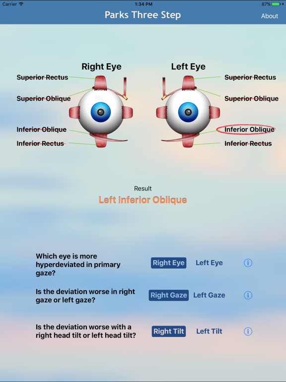 Screenshot #4 pour Parks Three Step