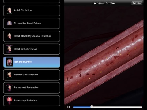 Cardiological Uno screenshot 4