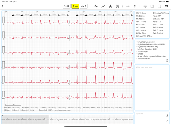 Screenshot #4 pour ECG for Doctors