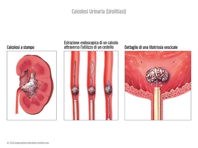 SIU, Urologia, tablet app(圖2)-速報App