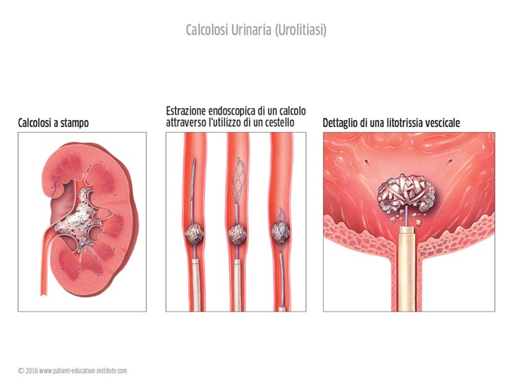 SIU, Urologia, tablet app