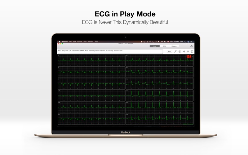 Screenshot #2 pour ECG PRO - for EMT