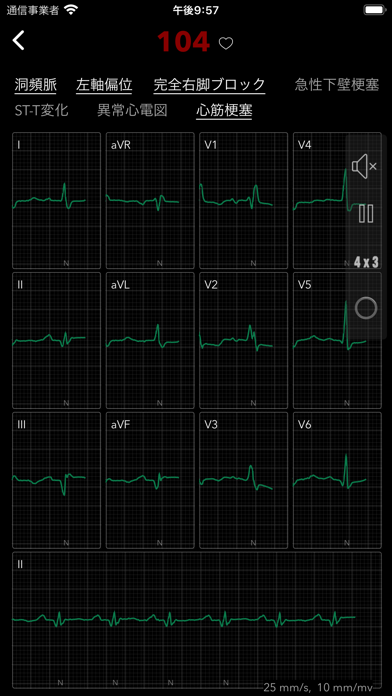 ECG Pro for Doctorsのおすすめ画像7