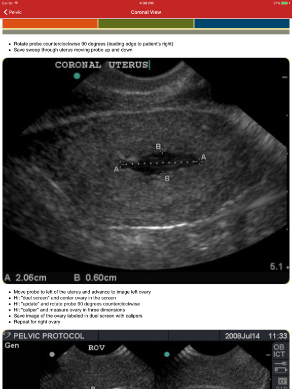 Screenshot #4 pour POC Ultrasound Guide