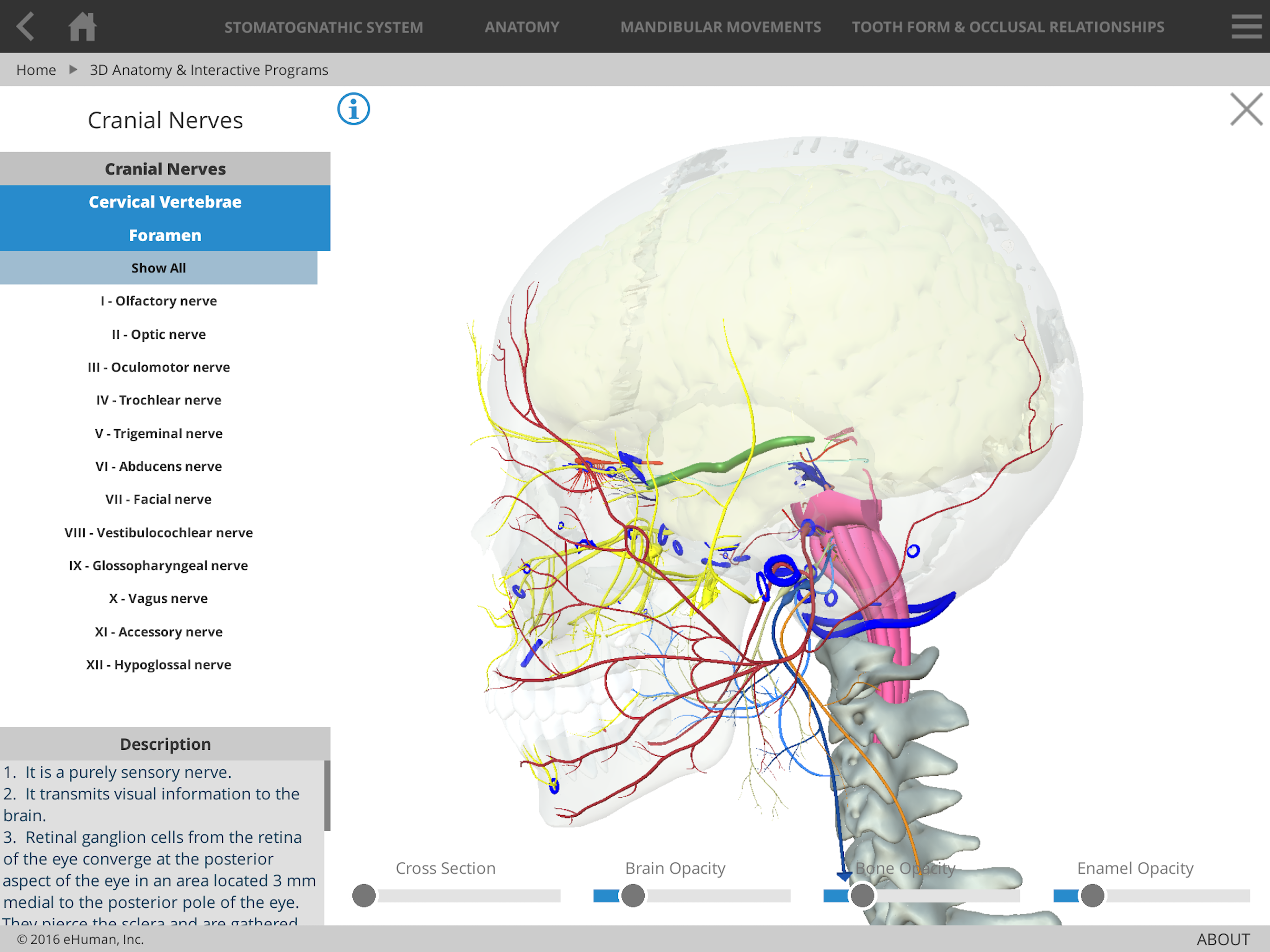 Occlusion Atlas 3 screenshot 3
