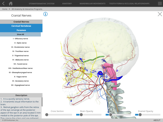 Screenshot #6 pour Occlusion Atlas 3