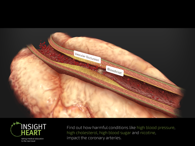 ‎INSIGHT HEART Screenshot