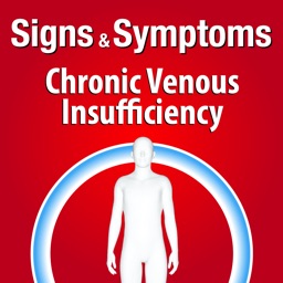 Signs & Symptoms Chronic Venous Insufficiency