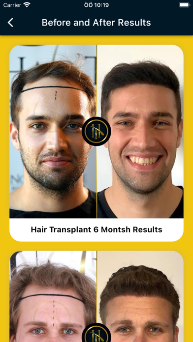 Hair Transplant Turkey - NHT Screenshot