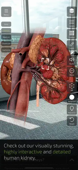 Game screenshot INSIGHT KIDNEY hack
