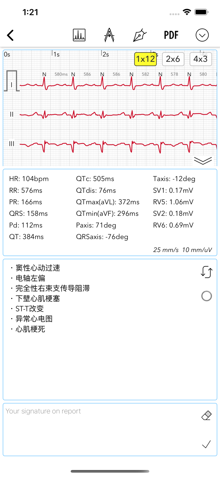 ECG for Doctors screenshot 4