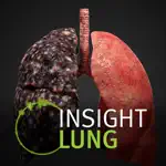 INSIGHT LUNG App Cancel