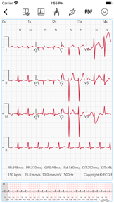 ECG Pro for Doctors screenshot