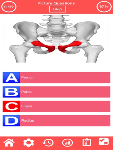 Human Skeletal System Quiz screenshot 3