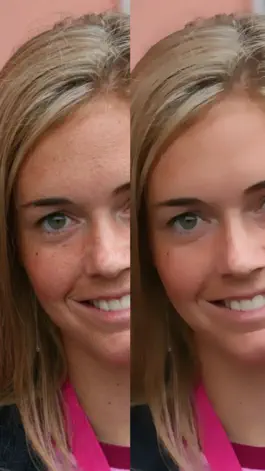 Game screenshot Look Younger - Perform Plastic Surgery on Photos hack