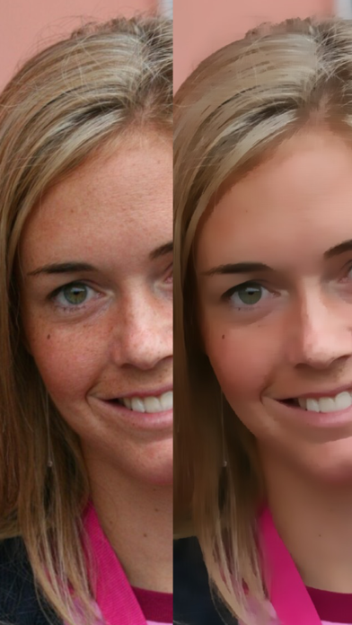 Look Younger - Perform Plastic Surgery on Photosのおすすめ画像3