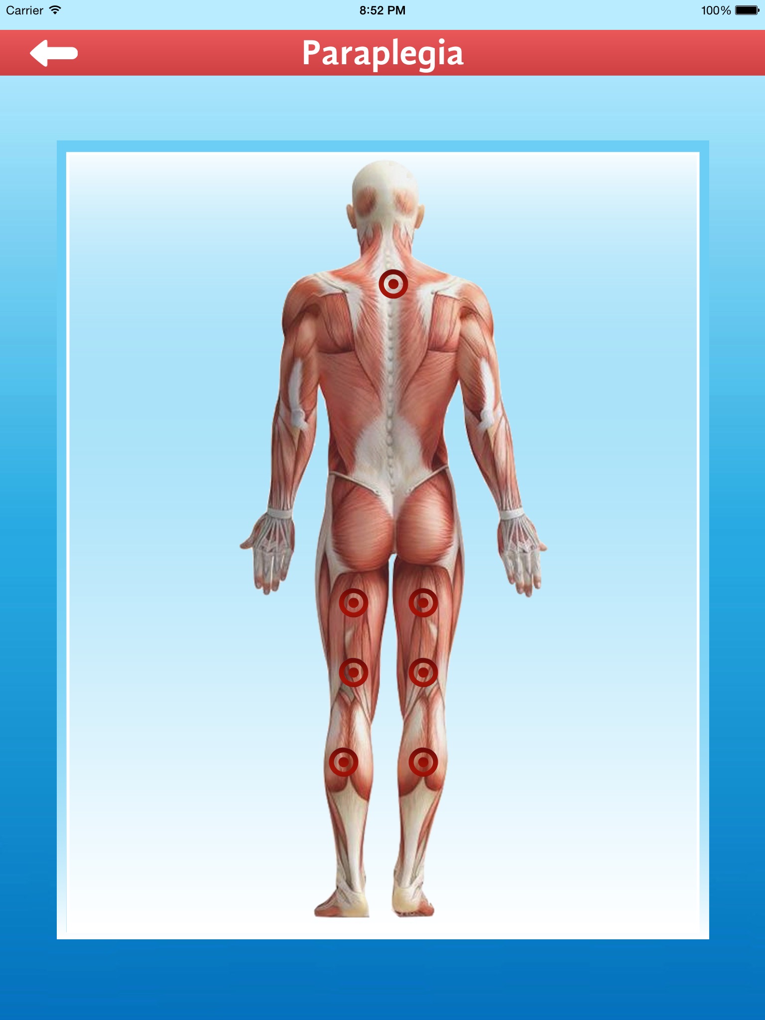 Cupping Therapy screenshot 2