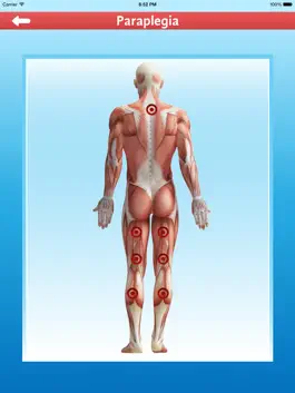 Game screenshot Cupping Therapy apk