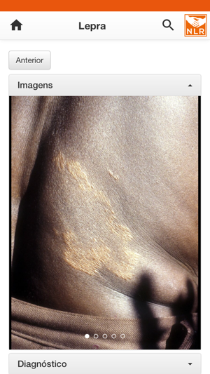 SkinApp MZ(圖4)-速報App