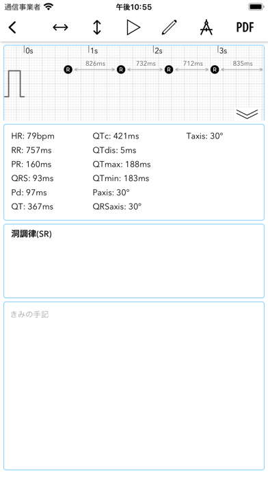 ECG+スクリーンショット