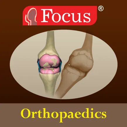 Orthopaedics - Understanding Disease Читы