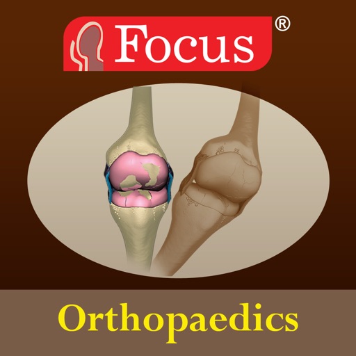 Orthopaedics - Understanding Disease
