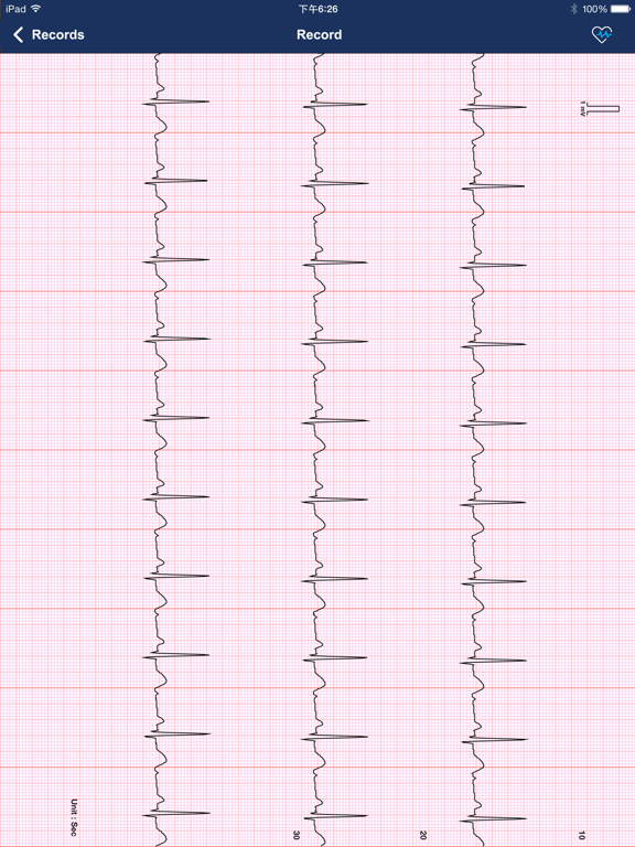 Screenshot #4 pour Beurer CardioExpert