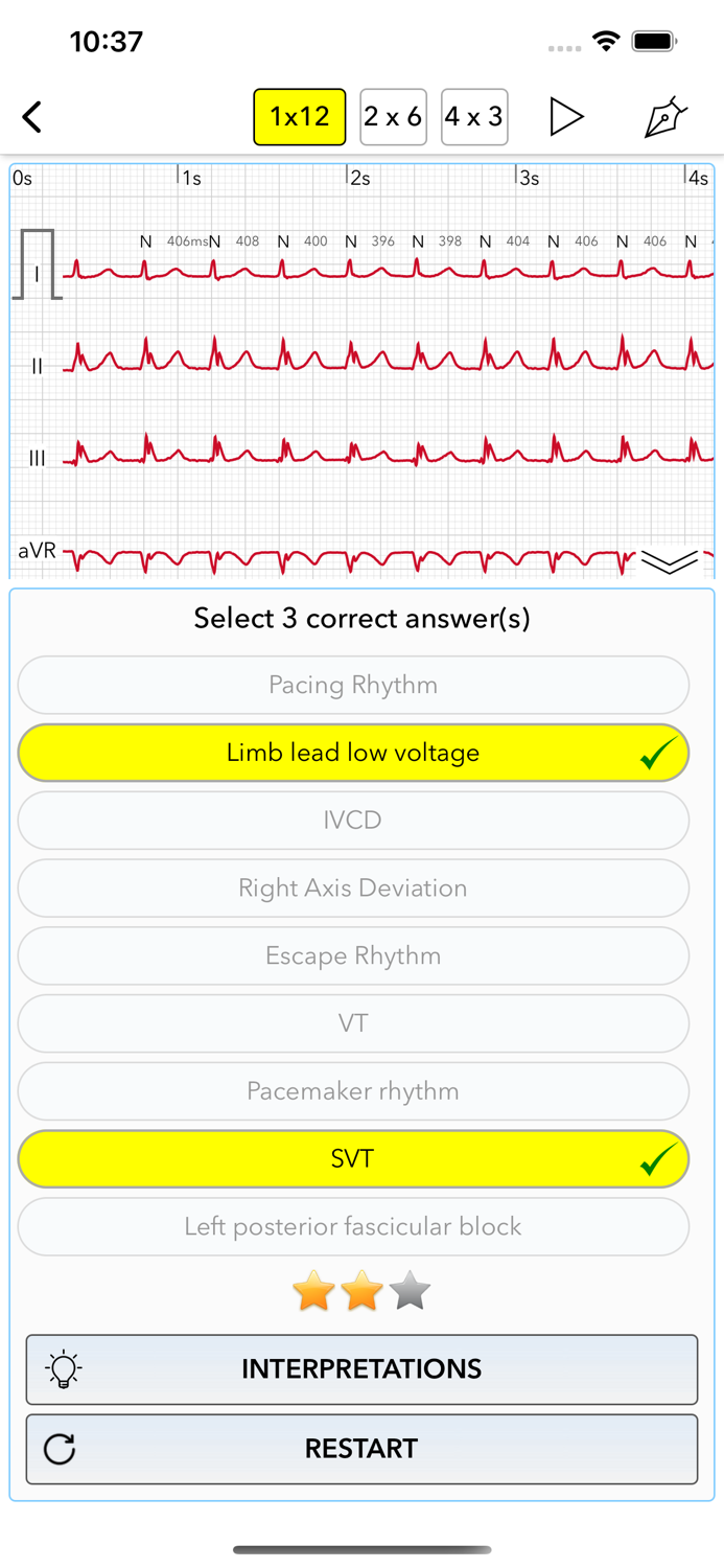 ECG Test for Doctors